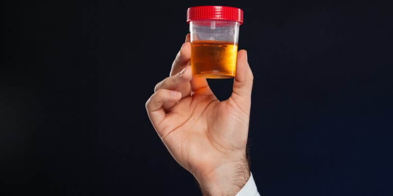 Exame de urina: orientações para coleta